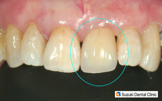 セラミック　調和　バランス
