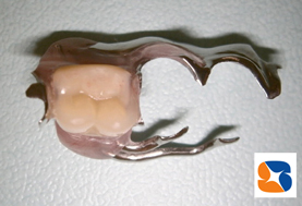 コンパクト入れ歯