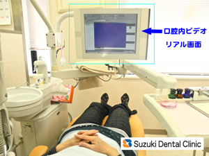 口の中の様子が隅々まで映しだされます。