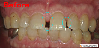 30年来のすき間