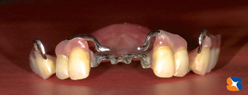 渾身の力作入れ歯