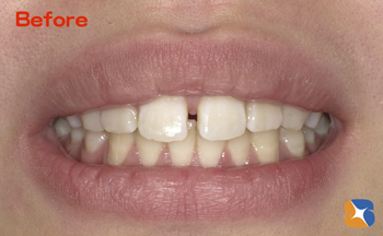 遠方からHPをみて来院