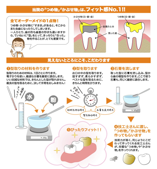 きっちり、丁寧、ぴったりフィット、ブリッジ