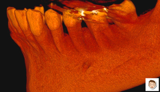 立体的な３D画像