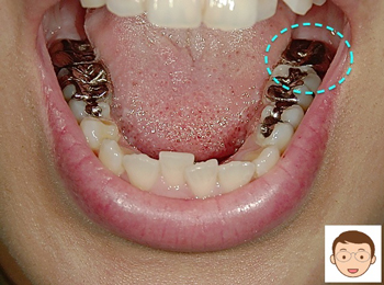今までは、レントゲンでのみ検査