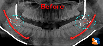 ペンタッチを使って大型スクリーンで説明