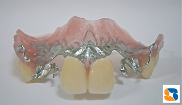 薄くてピッタリフィットの入れ歯