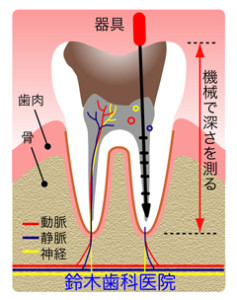 歯の構造イラスト