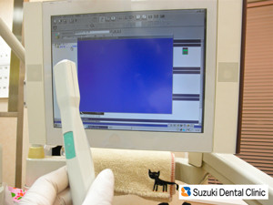 口腔内ビデオとモニター