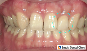 審美治療の最先端
