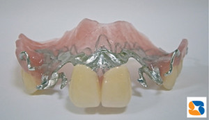 薄くてピッタリフィットの入れ歯