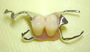 ミニ保険入れ歯