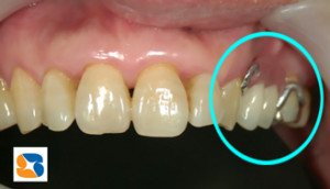 カタカタしたい　ぴったりフィット