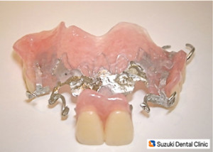 薄い　目立たない　確かなフィット感　保険の入れ歯でも凝ったデザイン