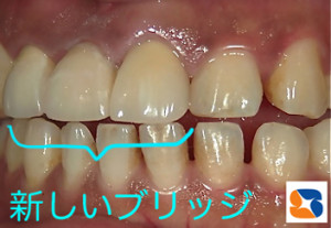 医院の技量レベルが問われる