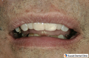 喜んで下さった患者様