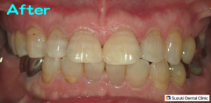 すき間を保険で解決