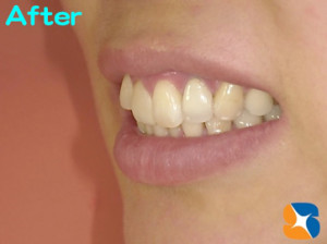 とても笑顔のステキな女性に変わりました