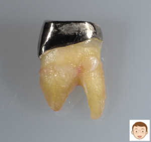 根の中を走行する神経管は人によって全て異なる