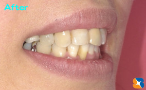 綺麗＆美しい口元