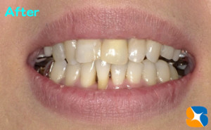 綺麗で美しい口元を再現