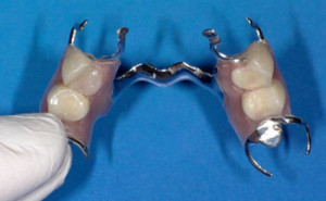 スタッフ一丸で作り上げた渾身の入れ歯