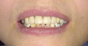 キレイな歯並びに風変わり