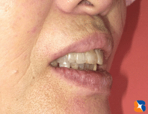 別人のような口元に変身