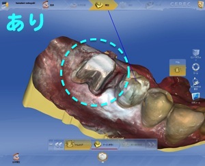 拡大器具で見た場合