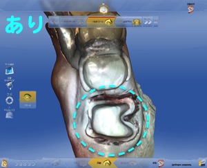 拡大鏡で見た場合