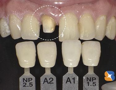 正確な色合わせ