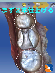 セレックで低価格治療