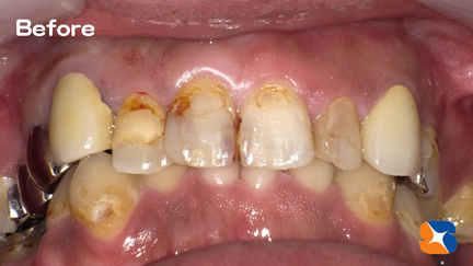 真夜中がんばって治療