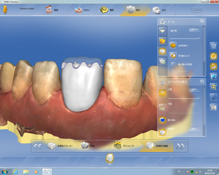 カットバック法で先部を透明色