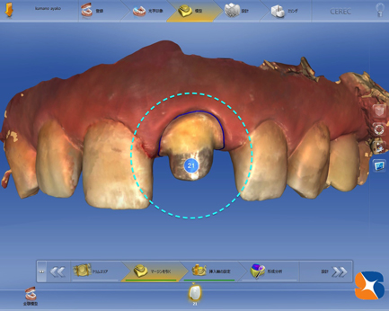 お口に中をセレックで読み込ませる