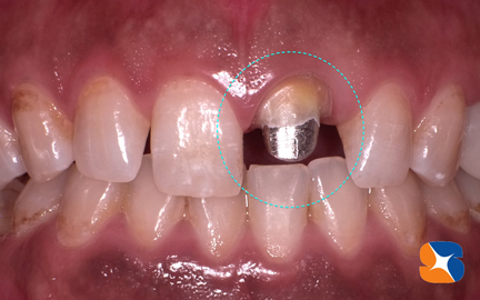 セレックで読み込む直前の状態