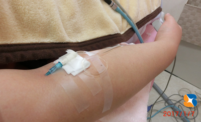 静脈鎮静法　麻酔　点滴