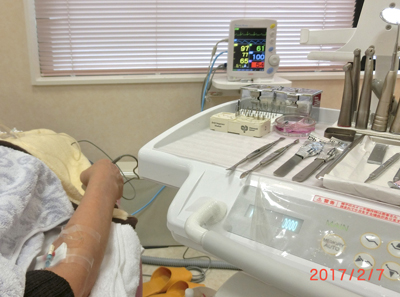 静脈麻酔鎮静法　IVS  点滴