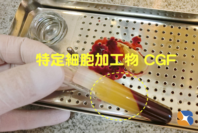 CGF　特定細胞加工物　血液由来