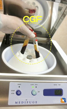 採血した血液から有能な細胞組織を抽出