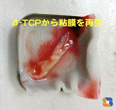 CGFを圧接して貴重な粘膜を作る