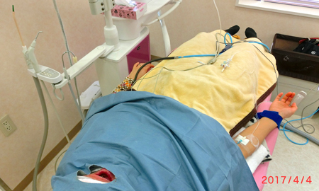 静脈保険適用　麻酔鎮静法で親知らずの抜歯