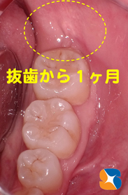 静脈麻酔鎮静法　保険料金