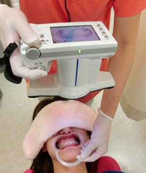 松風　歯科専用カメラ　最新