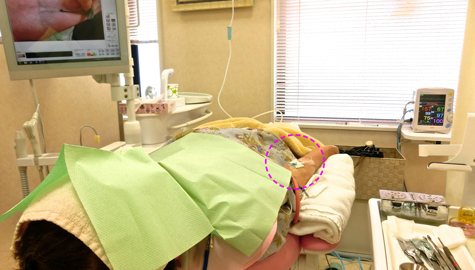 高齢者の麻酔鎮静法　インプラント