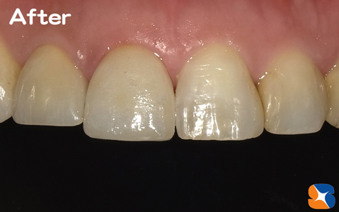 きっちり　丁寧　完璧　低価格　オールセラミック