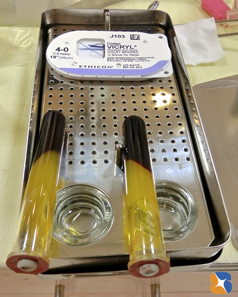 東大阪　生駒　奈良　親知らず抜歯　点滴