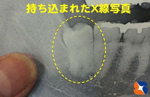 持ち込まれたレントゲン写真