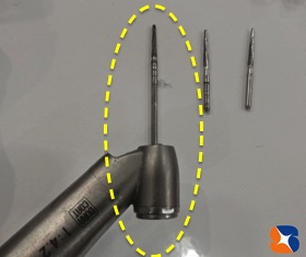 横向きの親知らずを抜歯する専用の特殊な器具
