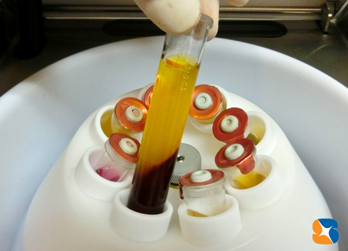 CGF 　再生医療　認可施設　無添加　自己血液を体内に戻す